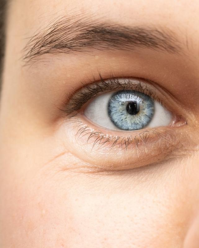 Dr. David Mognato pagina blefaroplastia