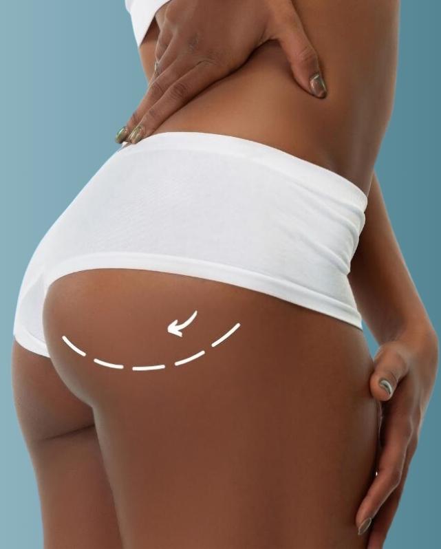 Dr. David gluteoplastia Pagina