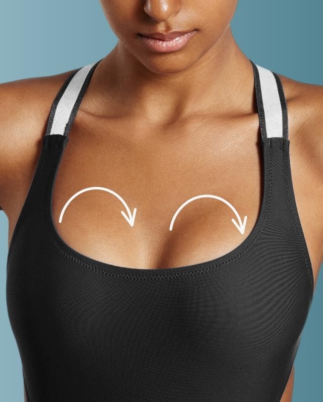 Mamoplastia - Pagina